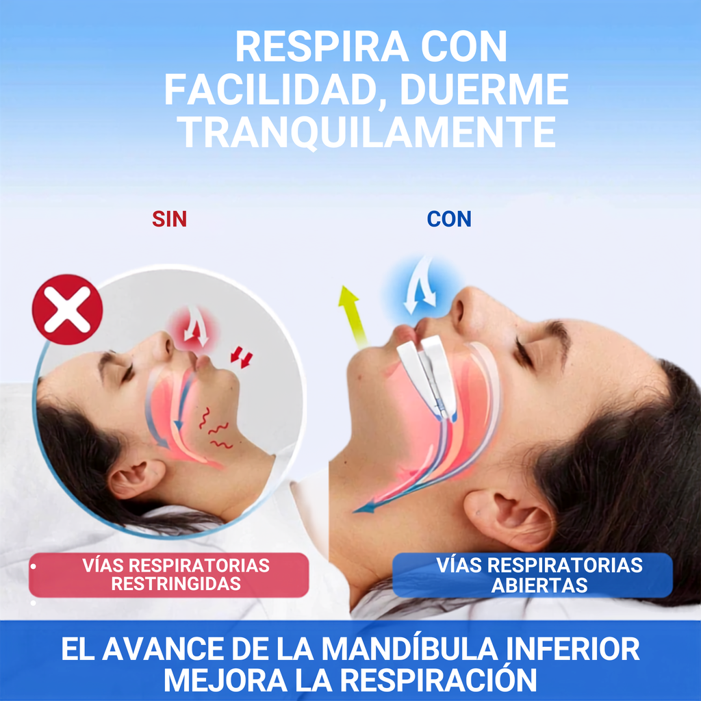 Adjustable Anti-Snoring Mouthpiece and Bruxism Guard